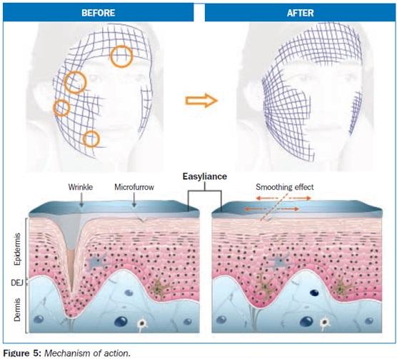 Easyliance (naravni botox)