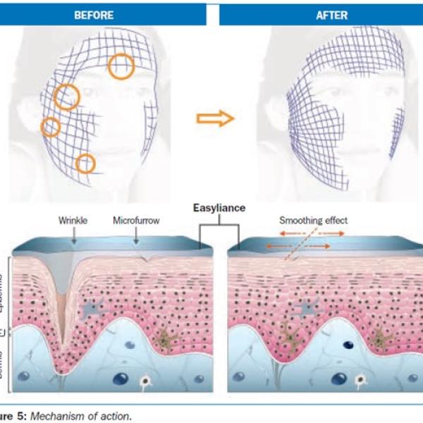 Easyliance (naravni botox)